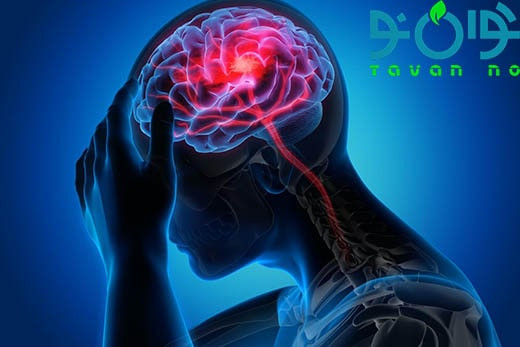 روش‌های پیشگیری از سکته مغزی-01